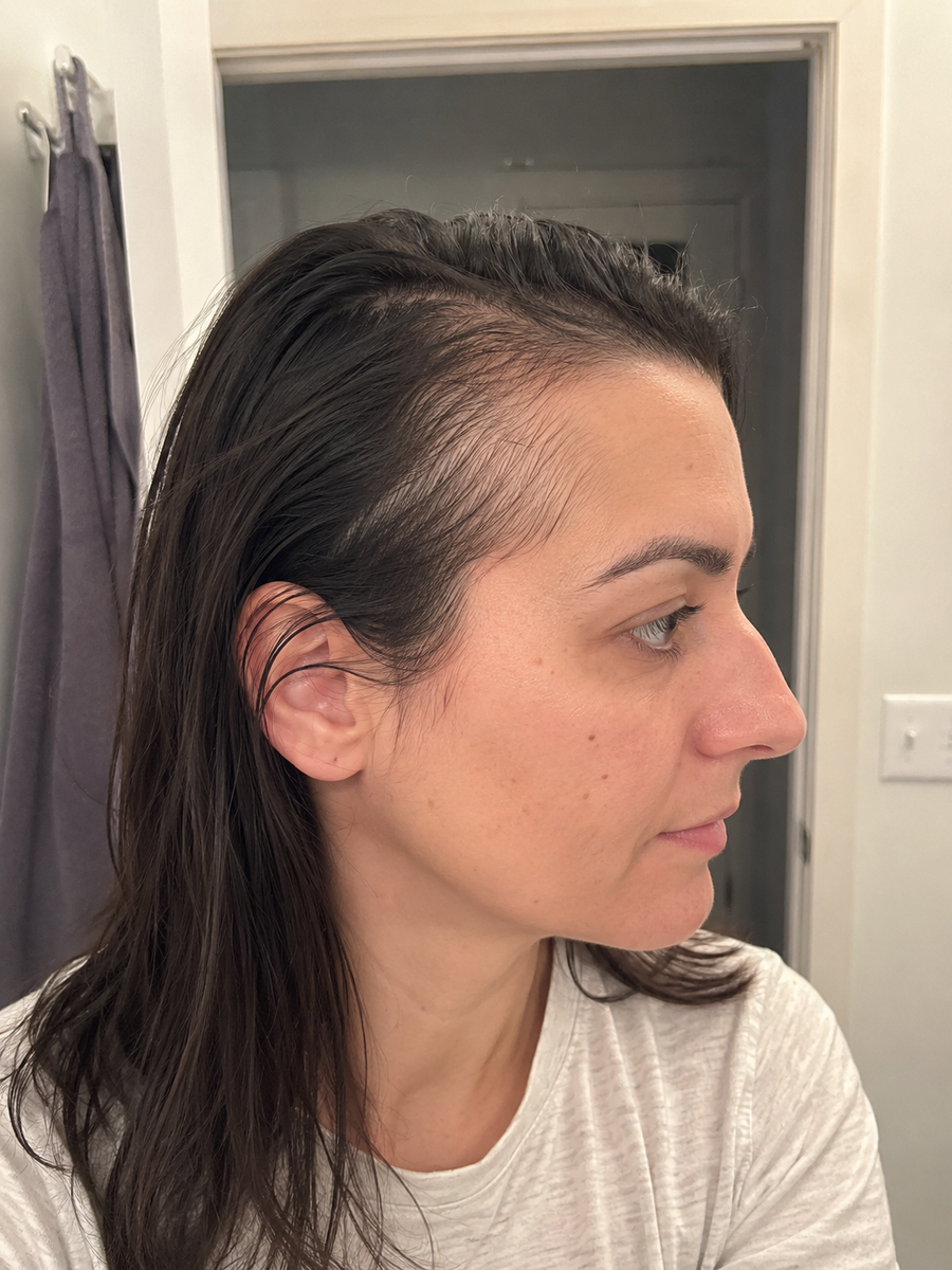 Month 0